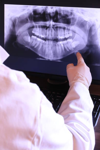 Best Emergency Dental Care for Broken or Chipped Teeth in Hamilton, AL