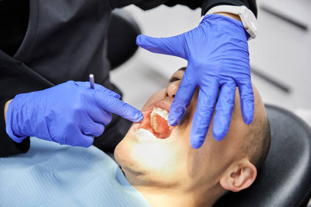 Best Emergency Treatment for Dental Infections or Abscesses in Hamilton, AL