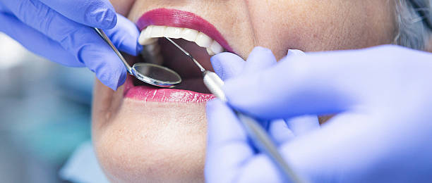Best Emergency Tooth Extraction in Hamilton, AL